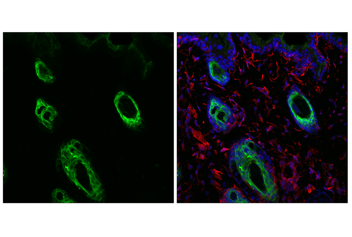 Immunofluorescence Image 1: Keratin 17/19 (D4G2) Rabbit Monoclonal Antibody (Alexa Fluor<sup>®</sup> 488 Conjugate)