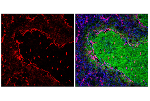 Immunofluorescence Image 2: CD36 (E8B7S) Rabbit Monoclonal Antibody (BSA and Azide Free)