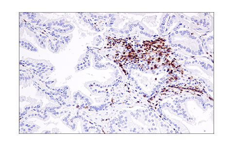 Immunohistochemistry Image 7: LAT (E3U6J) Rabbit Monoclonal Antibody (BSA and Azide Free)