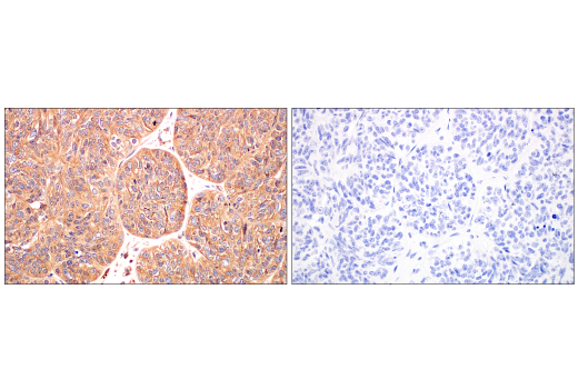Immunohistochemistry Image 1: ILK1 (4G9) Rabbit Monoclonal Antibody (BSA and Azide Free)