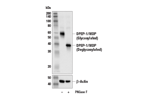 Western Blotting Image 2: DPEP-1/MDP (E5C2V) Rabbit Monoclonal Antibody
