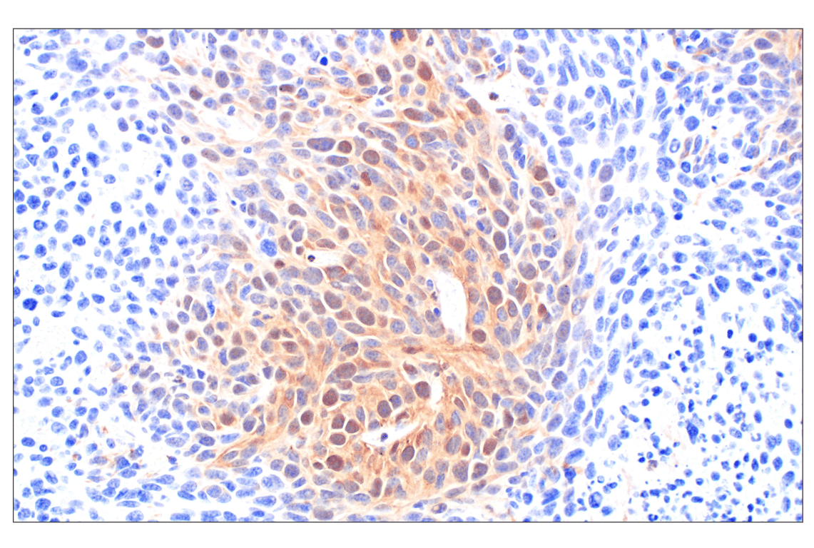 Immunohistochemistry Image 7: Phospho-ATP-Citrate Lyase (Ser455) (F4T8R) Rabbit Monoclonal Antibody
