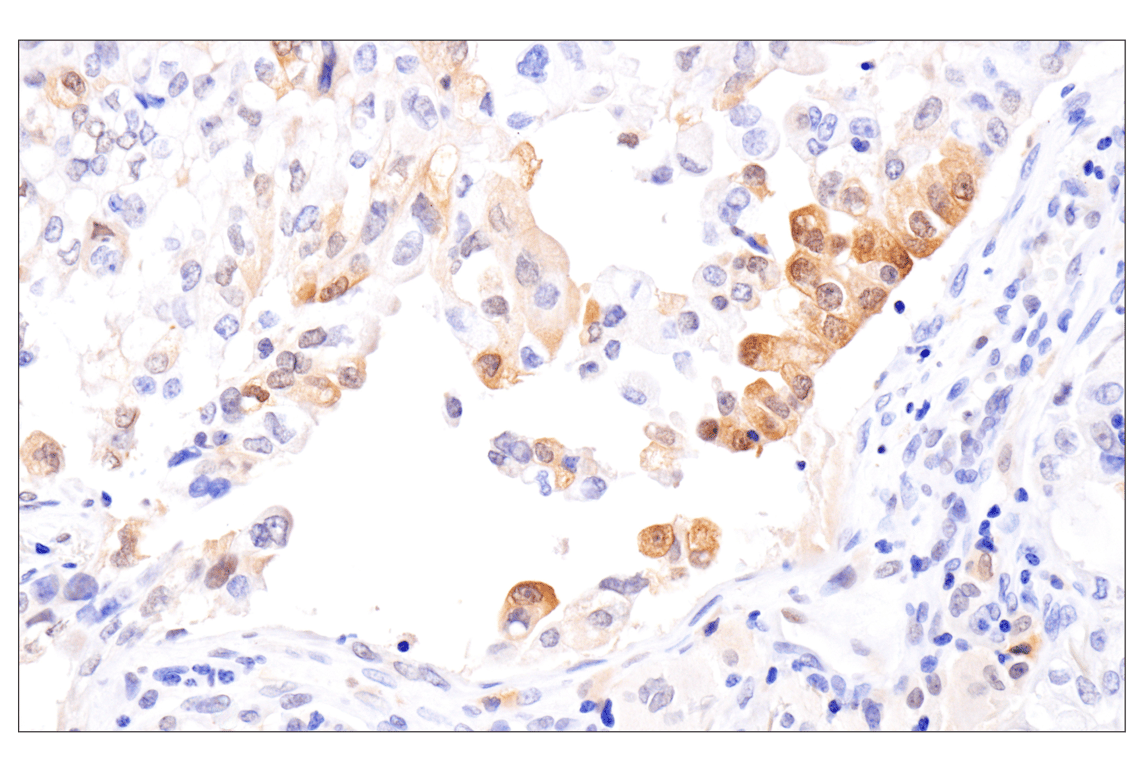 Immunohistochemistry Image 5: Phospho-Stat3 (Ser727) (D4X3C) Rabbit Monoclonal Antibody (BSA and Azide Free)