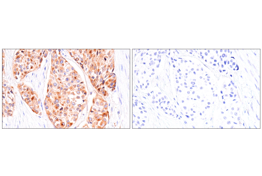 Immunohistochemistry Image 6: IGFBP3 (E6C2E) Rabbit Monoclonal Antibody