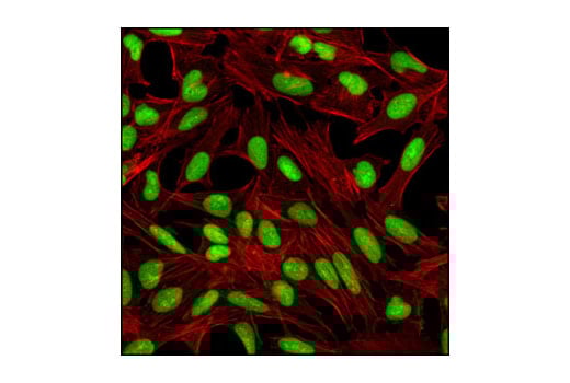undefined Image 17: Apoptosis Antibody Sampler Kit II