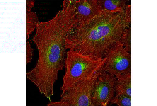 undefined Image 19: LRP1-mediated Endocytosis and Transmission of Tau Antibody Sampler Kit