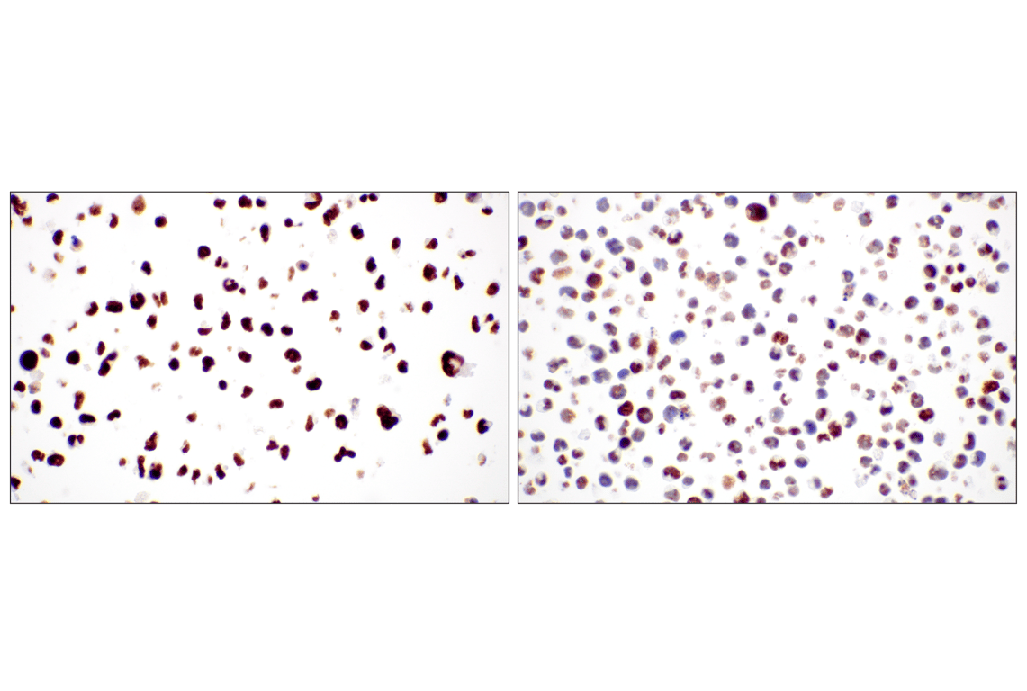 Immunohistochemistry Image 16: CBX7 (E7N1W) Rabbit Monoclonal Antibody