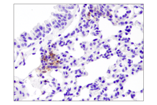Immunohistochemistry Image 2: PD-L1 (D5V3B) Rabbit Monoclonal Antibody (BSA and Azide Free)