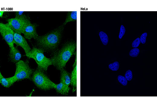 Immunofluorescence Image 1: NY-ESO-1 (D1Q2U) Rabbit Monoclonal Antibody