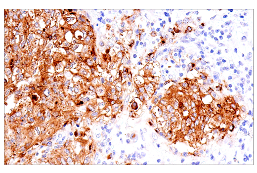 Immunohistochemistry Image 2: CEACAM6 (E7S7Y) Rabbit Monoclonal Antibody (BSA and Azide Free)