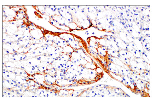 Immunohistochemistry Image 4: Periostin (E5F2S) Rabbit Monoclonal Antibody