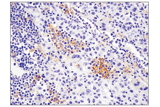 Immunohistochemistry Image 1: PD-L2 (D7U8C) Rabbit Monoclonal Antibody (BSA and Azide Free)