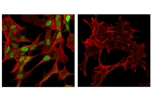 Immunofluorescence Image 1: Cyclin D1 (E3P5S) Rabbit Monoclonal Antibody