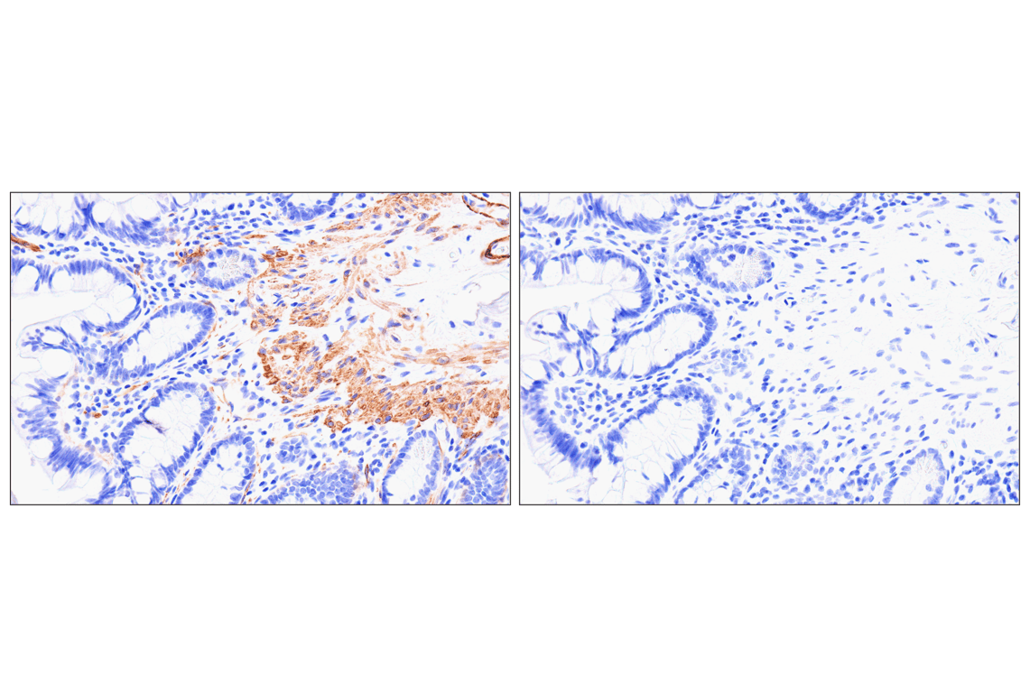 Immunohistochemistry Image 15: MYH11 (E4N8M) Rabbit Monoclonal Antibody (BSA and Azide Free)