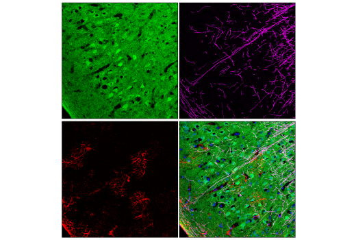Immunofluorescence Image 2: CDK5 (D1F7M) Rabbit Monoclonal Antibody