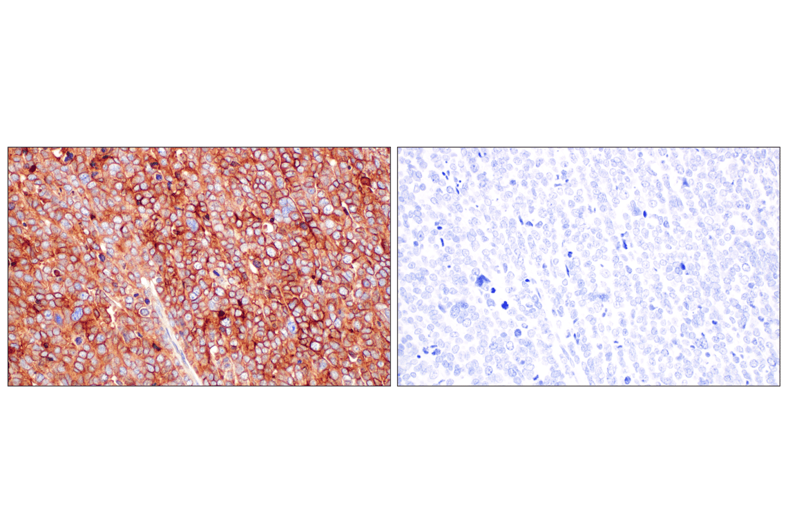 Immunohistochemistry Image 6: Folate Receptor Alpha/FOLR1 (E8U2F) Mouse Monoclonal Antibody