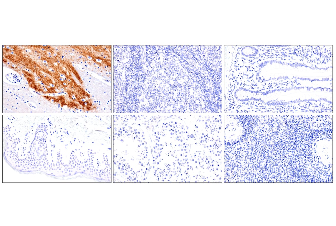 Immunohistochemistry Image 4: VGLUT1 (E8L5B) Rabbit Monoclonal Antibody