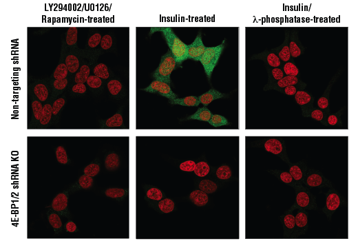 Immunofluorescence Image 1: Phospho-4E-BP1 (Thr37/46) (236B4) Rabbit Monoclonal Antibody (BSA and Azide Free)