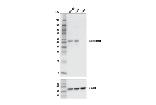 Western Blotting Image 1: FXR/NR1H4 (E4B8P) Mouse mAb