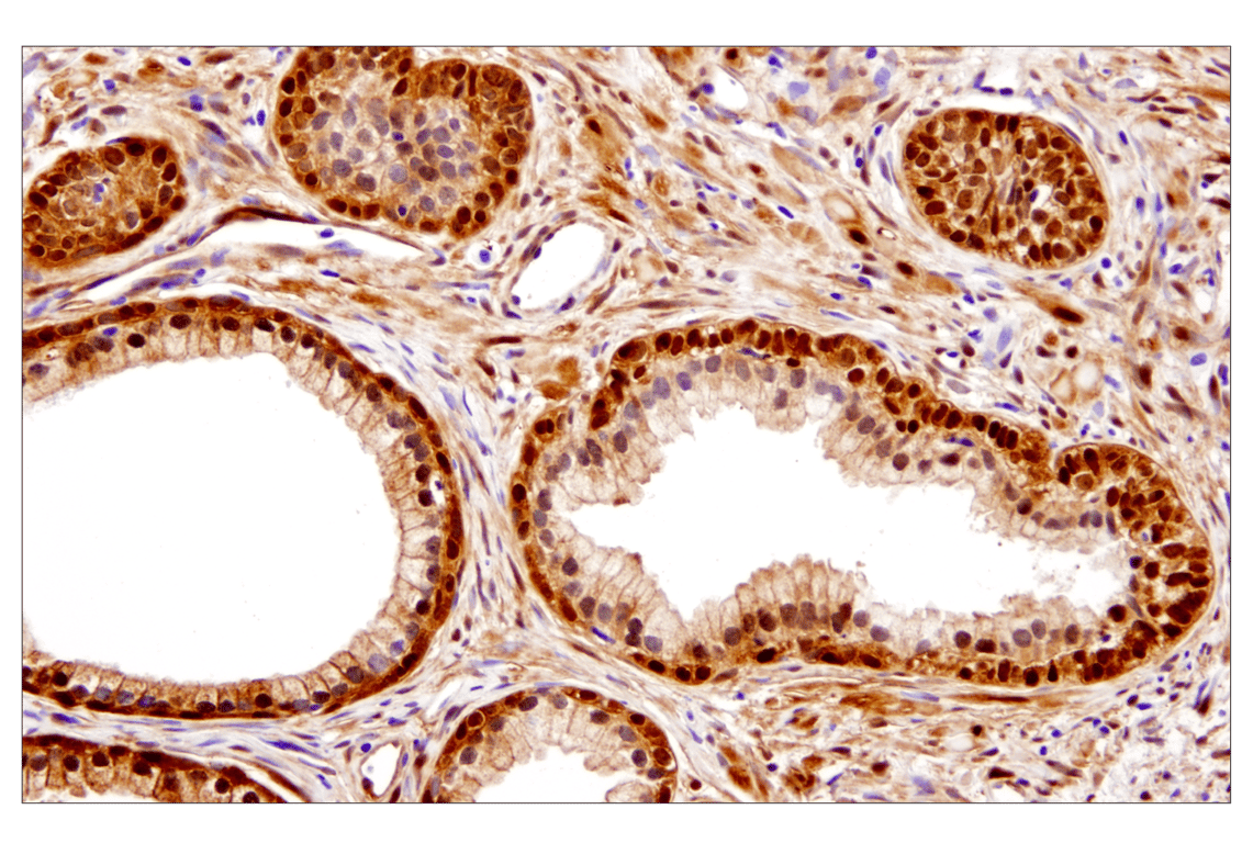 Immunohistochemistry Image 5: YAP (D8H1X) Rabbit Monoclonal Antibody