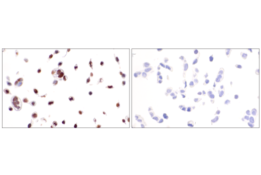 Immunohistochemistry Image 4: p40 (BC28) Mouse Monoclonal Antibody