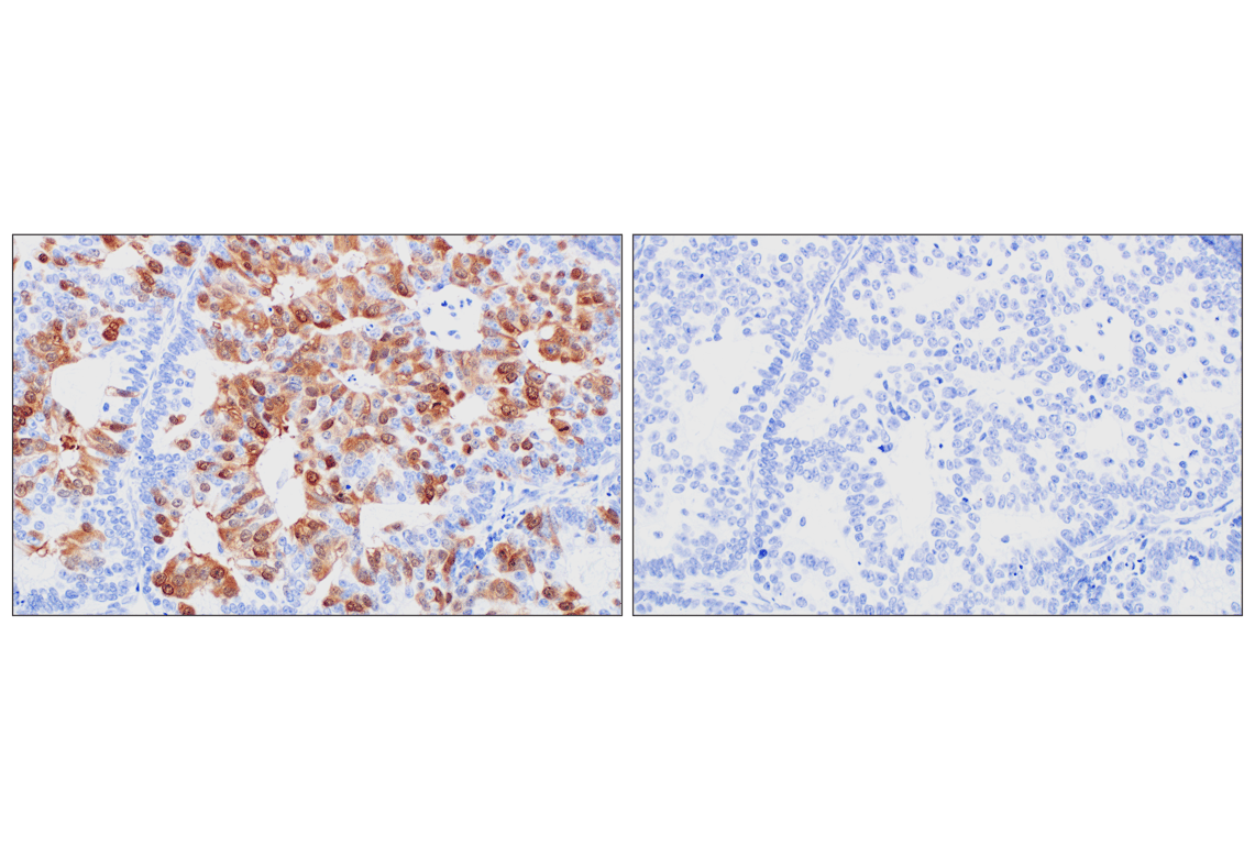 Immunohistochemistry Image 11: PBK/TOPK (F2X2Z) Rabbit Monoclonal Antibody