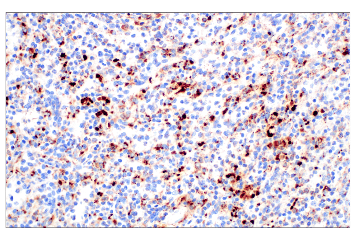Cathepsin Z (F4M4S) Rabbit Monoclonal Antibody | Cell Signaling