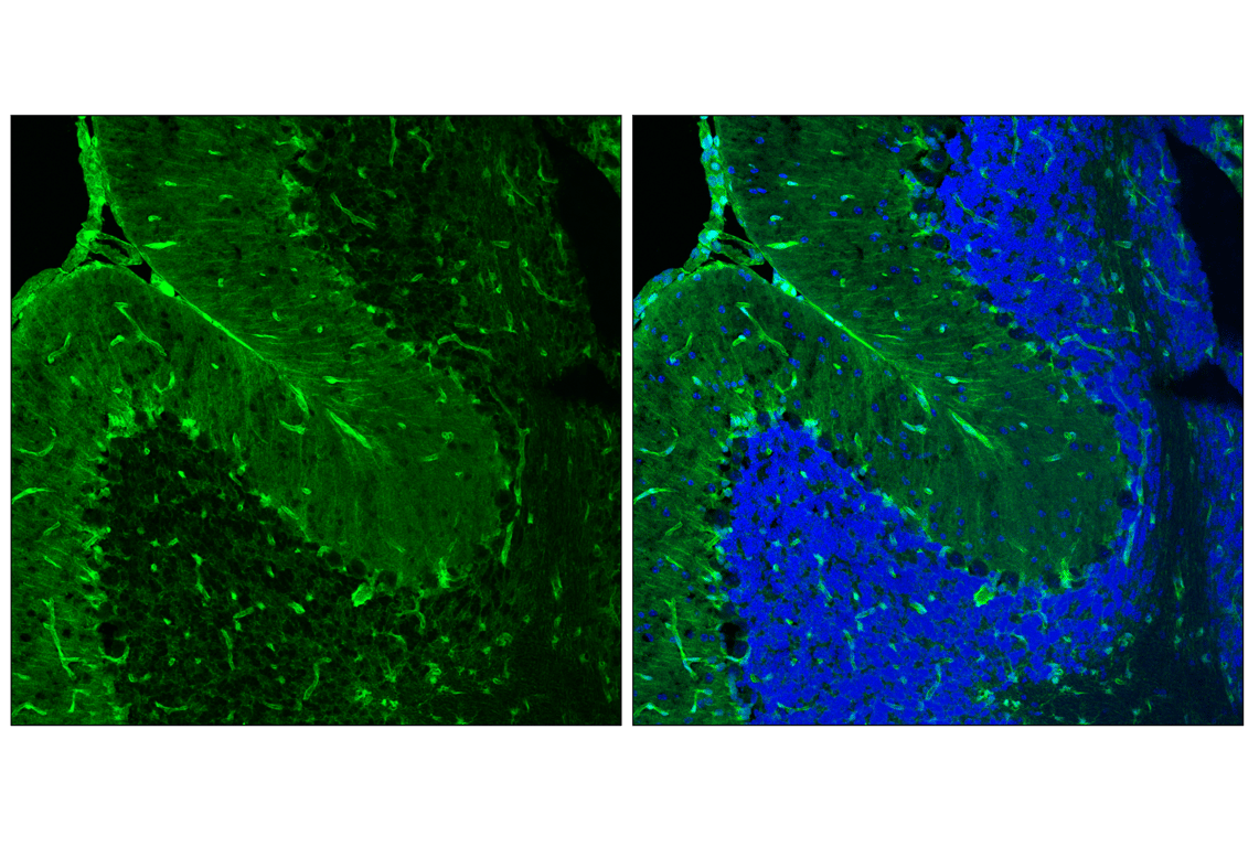 Immunofluorescence Image 3: YAP (D8H1X) Rabbit Monoclonal Antibody