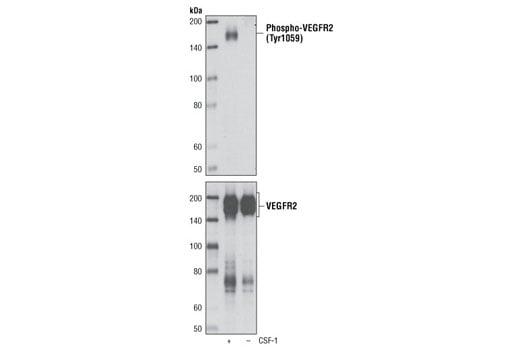 undefined Image 3: Phospho-VEGF Receptor 2 Antibody Sampler Kit