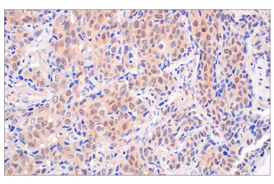 Immunohistochemistry Image 3: BLVRA (F7Z7R) Rabbit Monoclonal Antibody
