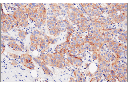 Immunohistochemistry Image 1: Nectin-2/CD112 (D8D3F) Rabbit Monoclonal Antibody