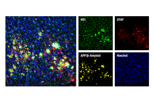 Immunofluorescence Image 2: HS1 (D5A9) Rabbit Monoclonal Antibody (BSA and Azide Free)