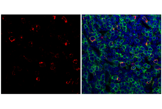 Immunofluorescence Image 2: CTLA-4 (E5S7E) Rabbit Monoclonal Antibody