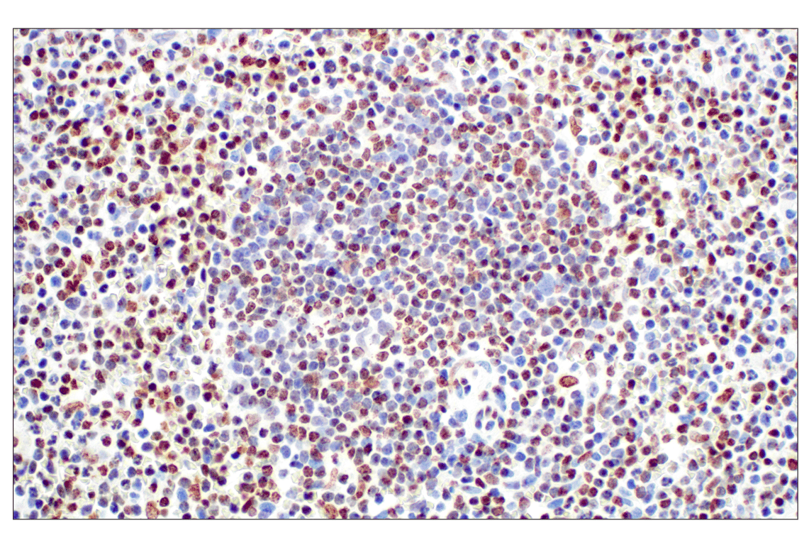 Immunohistochemistry Image 4: Tri-Methyl-Histone H3 (Lys27) (C36B11) Rabbit Monoclonal Antibody