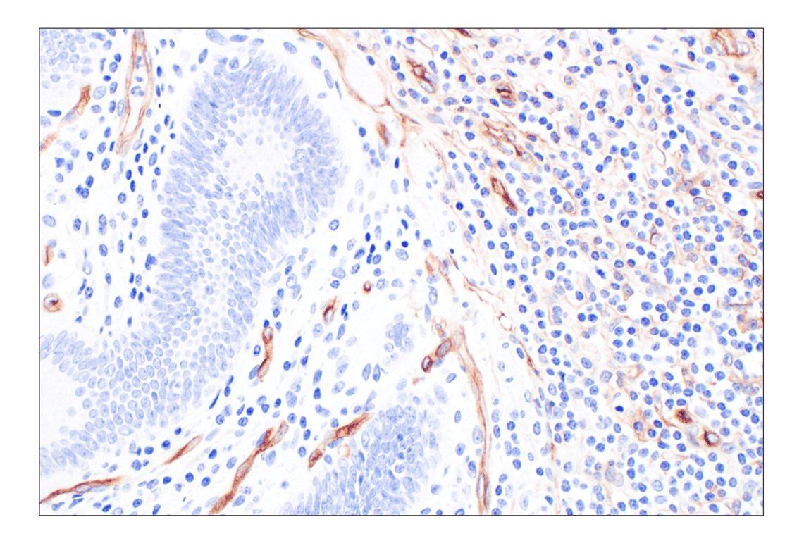 Immunohistochemistry Image 7: CD34 (QBEND/10) Mouse Monoclonal Antibody