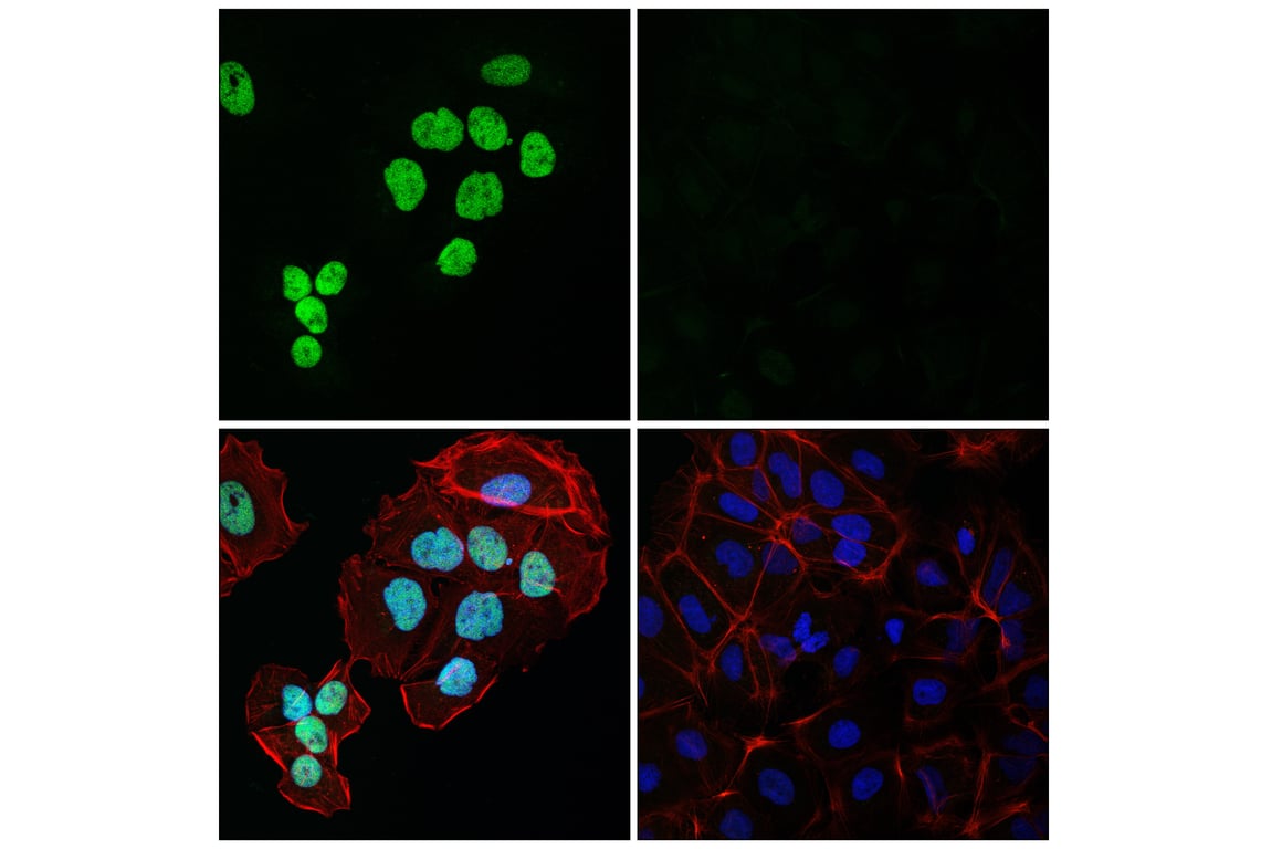 Immunofluorescence Image 1: NFI-B (E5L7U) Rabbit Monoclonal Antibody