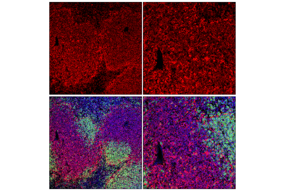 Immunofluorescence Image 3: STING (E9X7F) Rabbit Monoclonal Antibody