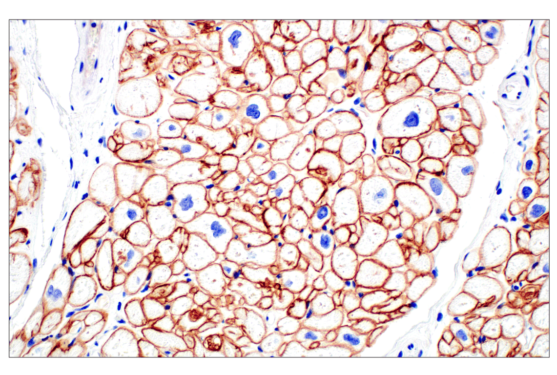Immunohistochemistry Image 4: Dystrophin (E4F3S) Rabbit Monoclonal Antibody