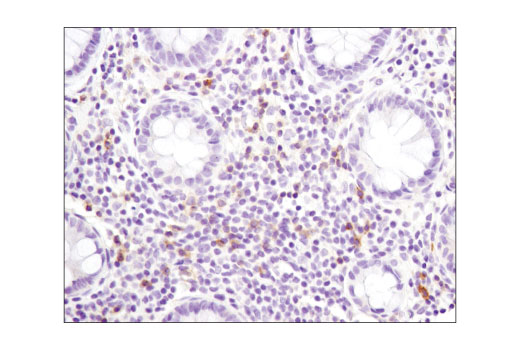 Immunohistochemistry Image 1: GITR (D9I9D) Rabbit Monoclonal Antibody
