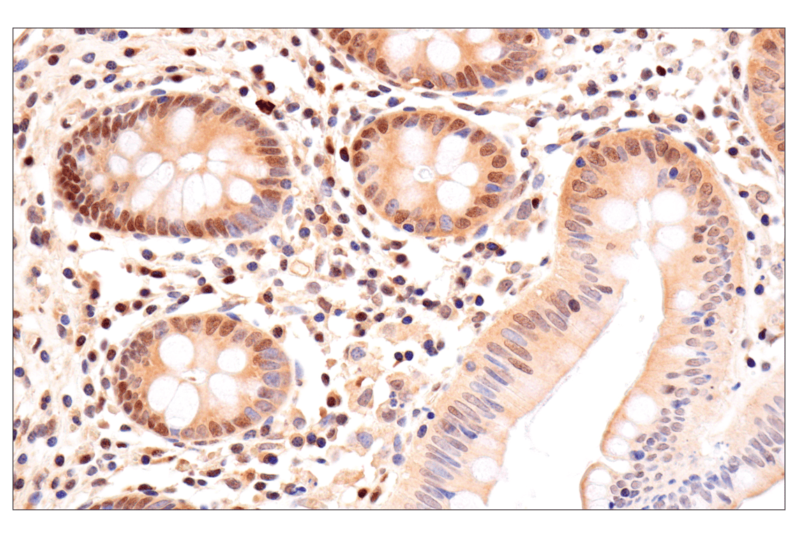Immunohistochemistry Image 9: CRBN (F4I7F) Rabbit mAb