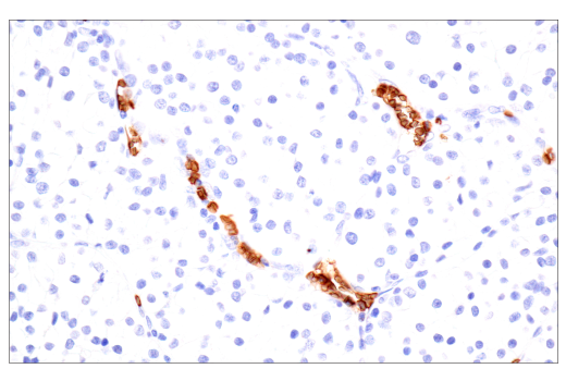 Immunohistochemistry Image 2: CD235a/Glycophorin A (JC159) Rabbit Monoclonal Antibody