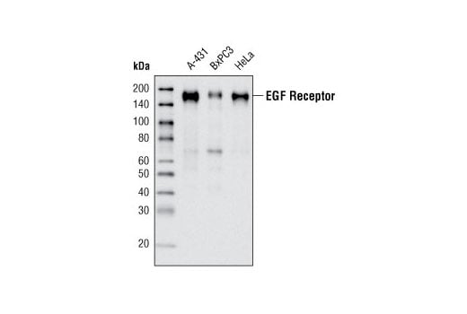 Western Blotting Image 2: EGF Receptor (D38B1) Rabbit Monoclonal Antibody