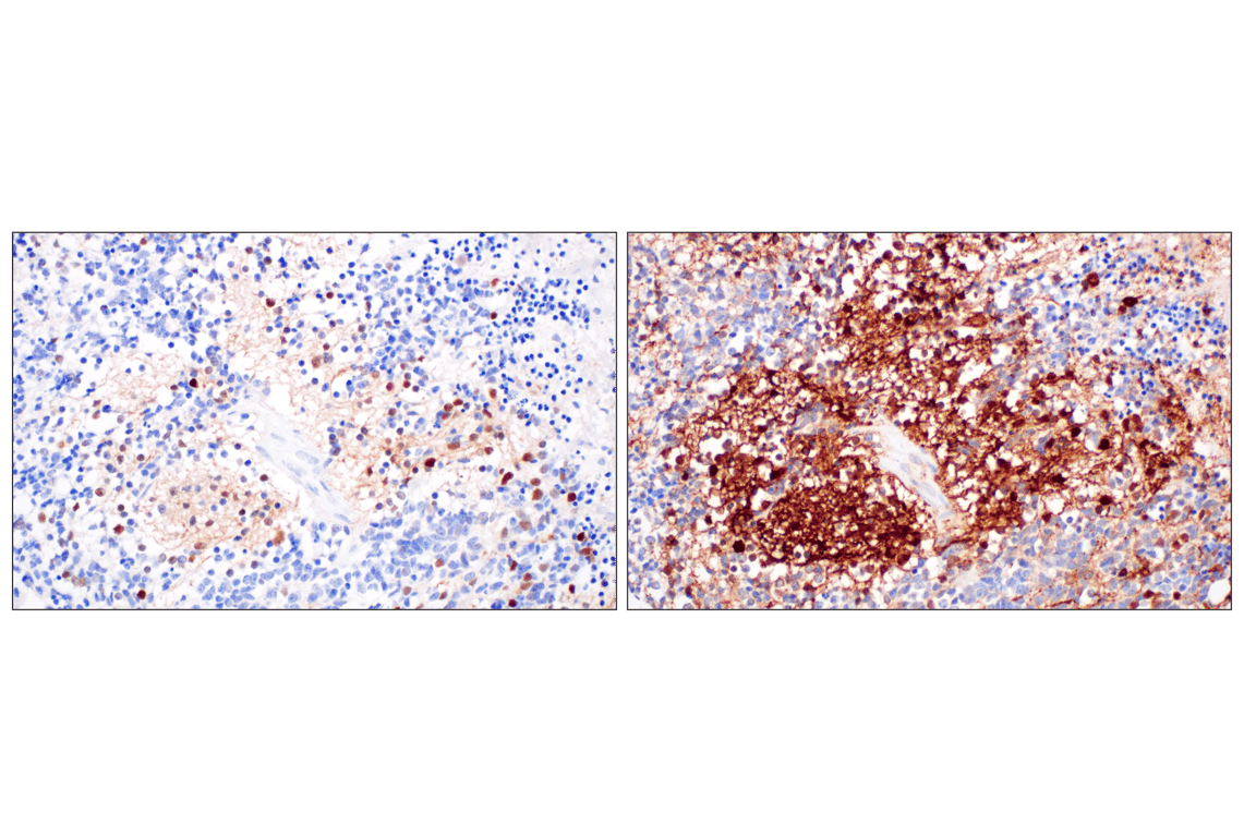 Immunohistochemistry Image 2: Phospho-alpha-Synuclein (Ser129) (D1R1R) Rabbit Monoclonal Antibody