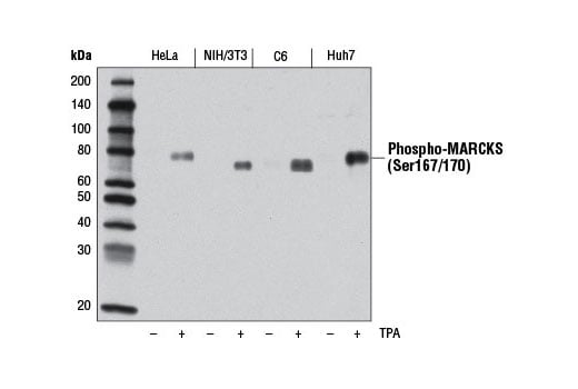 Western Blotting Image 2: Phospho-MARCKS (Ser167/170) (D13E4) Rabbit Monoclonal Antibody