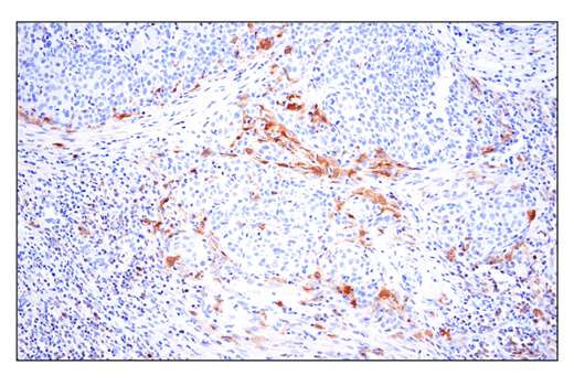 Phospho-SLP-76 (Ser376) (E3G9U) XP® Rabbit mAb | Cell