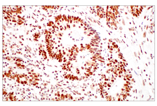 Immunohistochemistry Image 1: METTL3 (E3F2A) Rabbit Monoclonal Antibody (BSA and Azide Free)