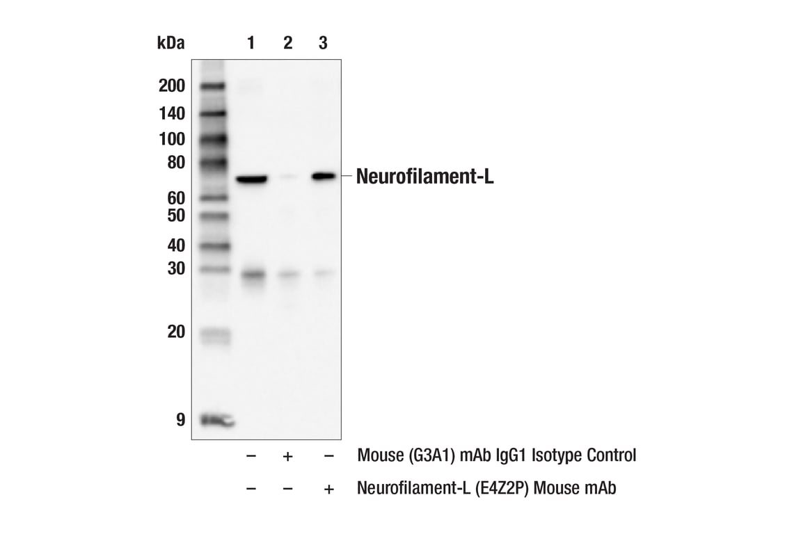 Immunoprecipitation Image 1: Neurofilament-L (E4Z2P) Mouse Monoclonal Antibody