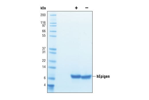 undefined Image 2: Human Epigen