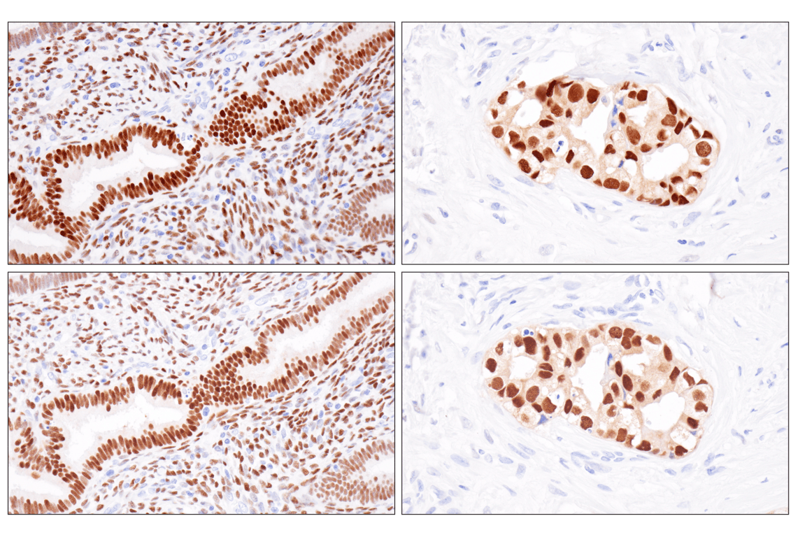 Immunohistochemistry Image 2: Estrogen Receptor alpha (D8H8) Rabbit Monoclonal Antibody