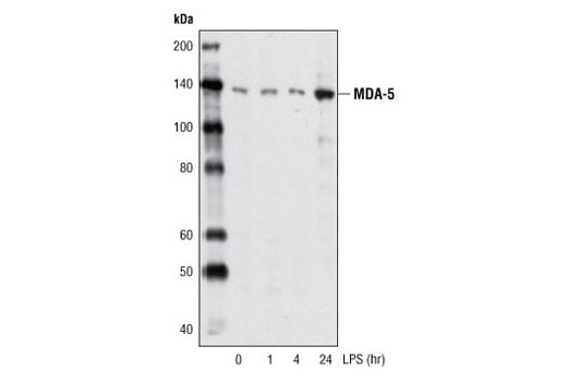 undefined Image 14: Rig-I Pathway Antibody Sampler Kit